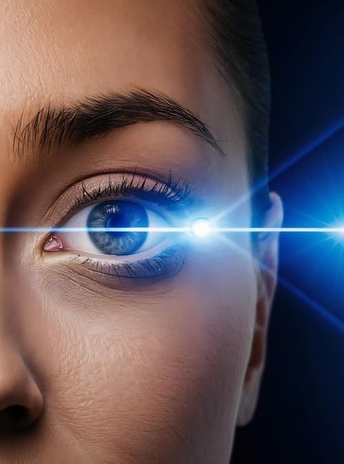 Laser de surface/PKR